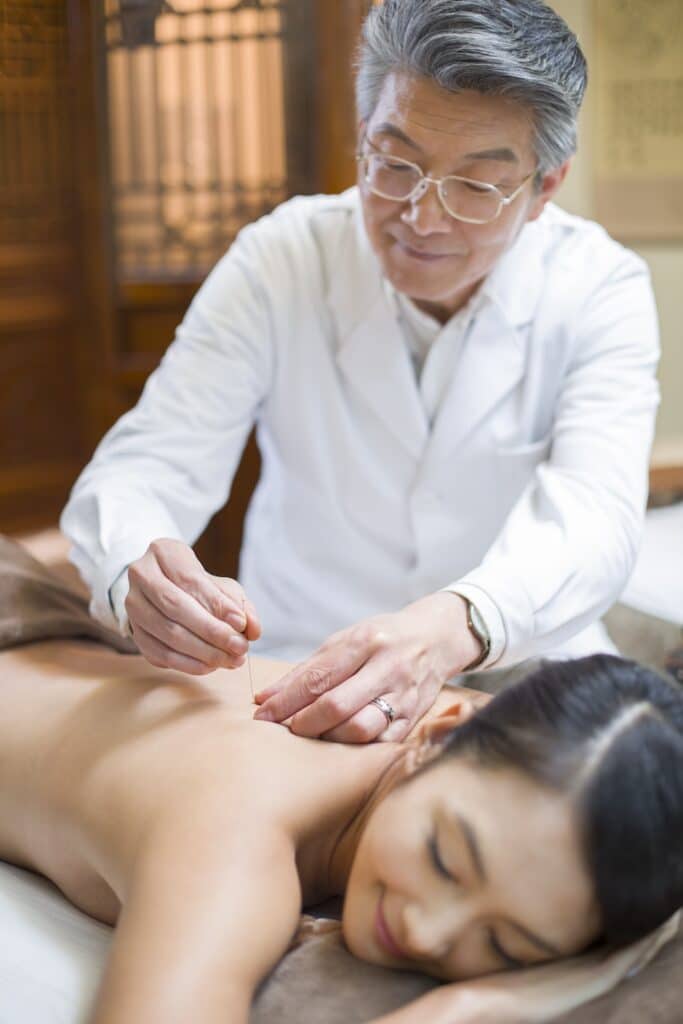 Young Chinese woman receiving acupuncture