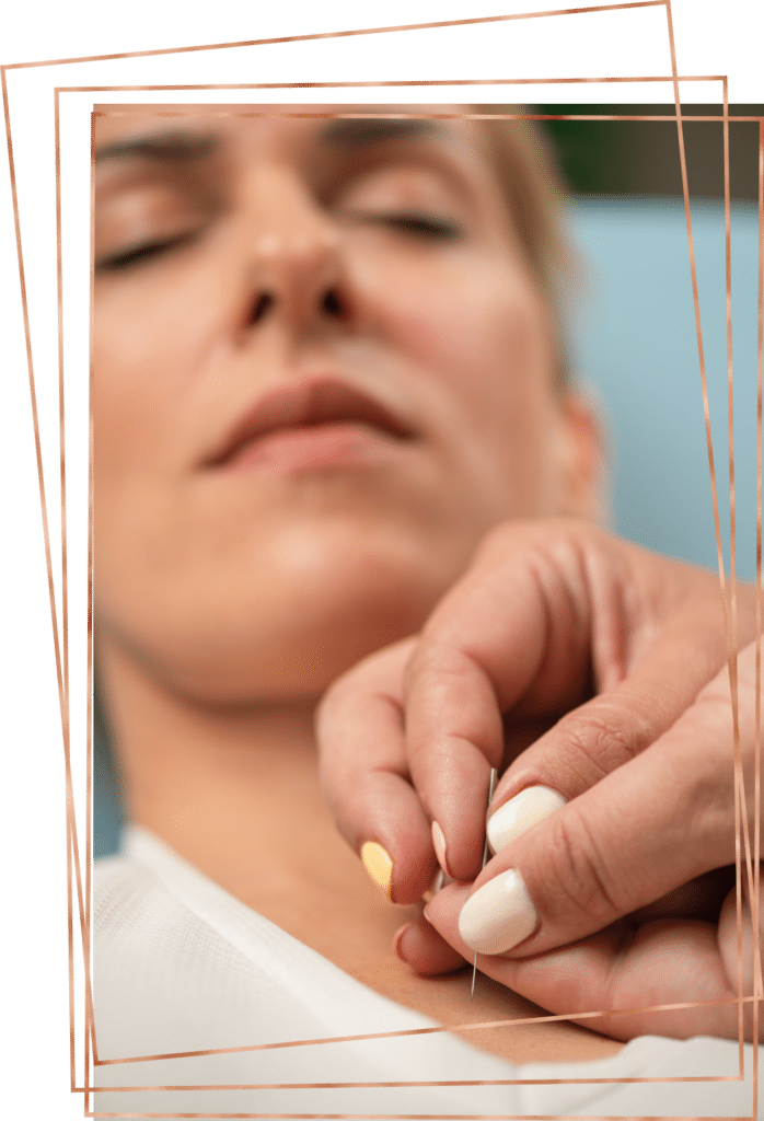 Acupuncture Group Psychotherapy in Idyllwild California in Riverside County Mental Health Residential Treatment Center