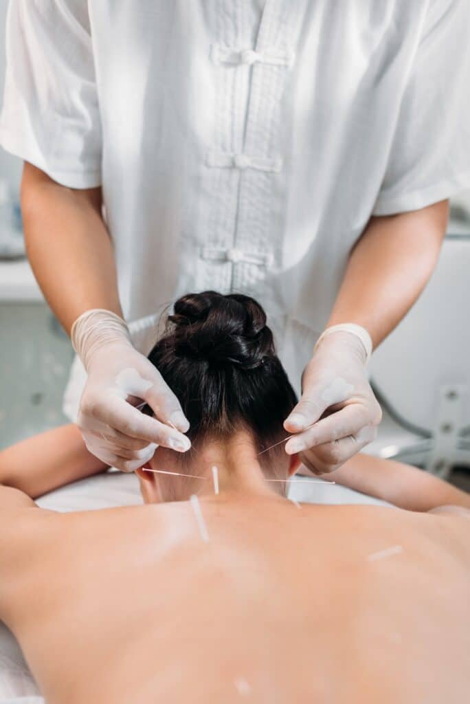 Cropped shot of practitioner putting needles on womans body during acupuncture therapy